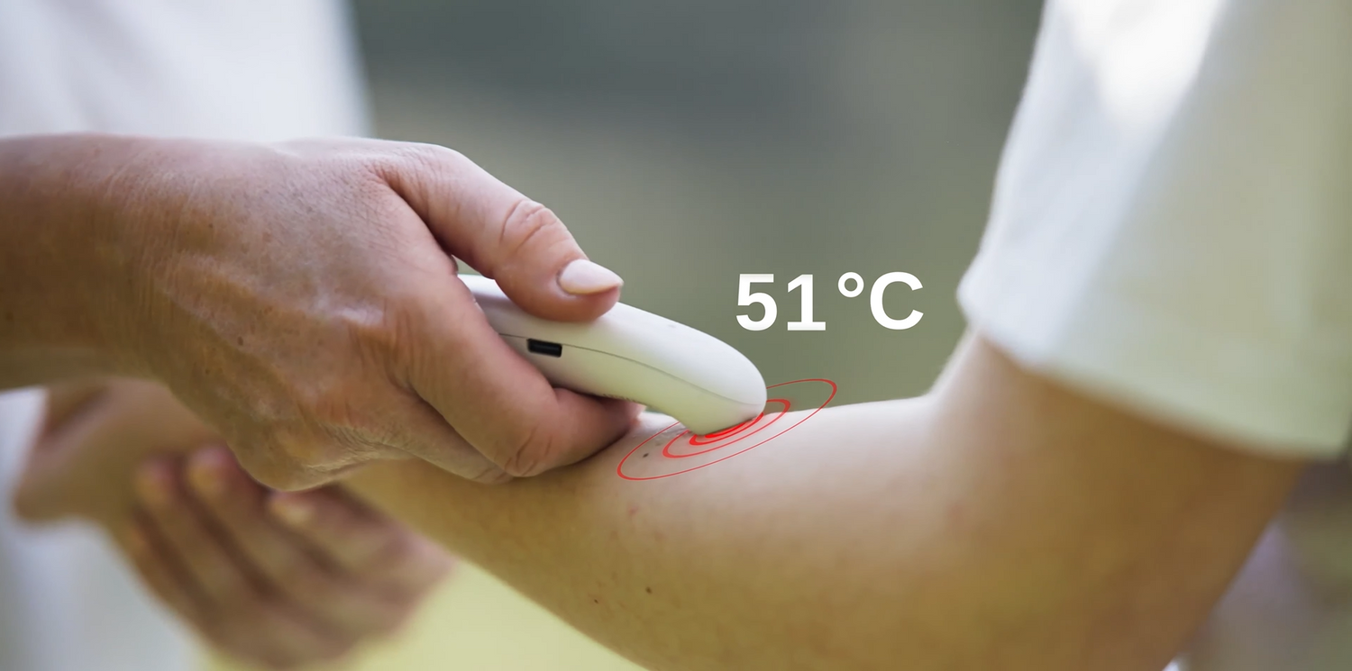 Hand hält Insektenstichheiler an den Unterarm; Einblendung „51°C“ zeigt die Wärmestufe/Temperaturanzeige.